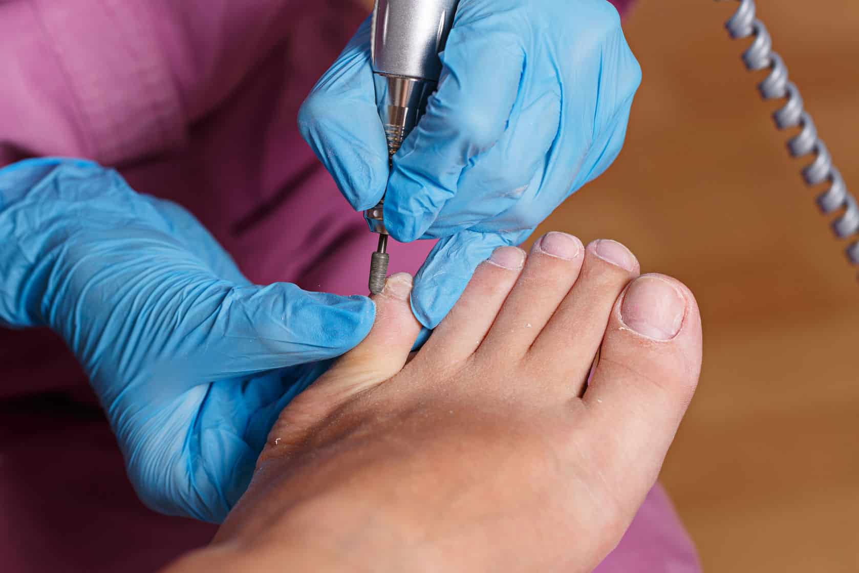 Podiatrist In Burnley Podiatrychiropody Appointments Physiofusion